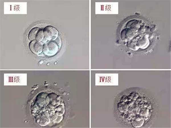 胚胎5细胞有20%碎片是继续养囊还是移植比较好？