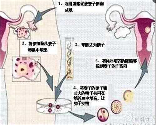 上海代生孩子多少钱,女学生腹部疼痛以为是怀孕
