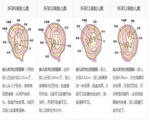 上海代孕包生女孩多少钱_打过胎去孕检能查出来吗 孕检内容要知晓
