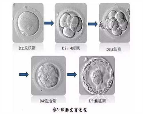 上海正规三甲医院代孕_受精卵几天b超能看出