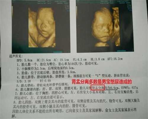 上海正规代孕价格_月经没来检查hcg确定没怀孕吗