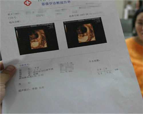 上海代孕中介公司_怀孕多久补钙和补dha
