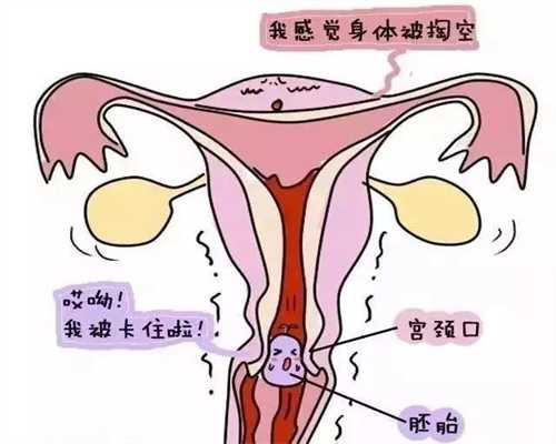 上海代孕产子费用_孕早期腹痛是什么感觉