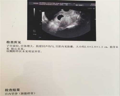 上海包成功代孕生女孩多少钱_精子射过后排卵日当天同房会怀孕吗