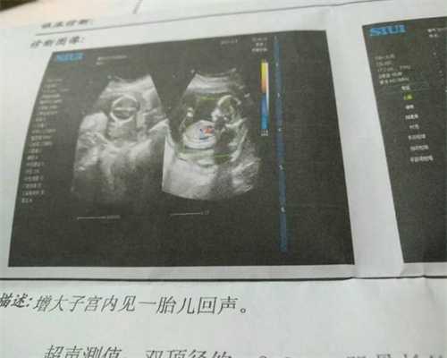 上海代孕总费用_正确避孕，拒绝“被当妈”