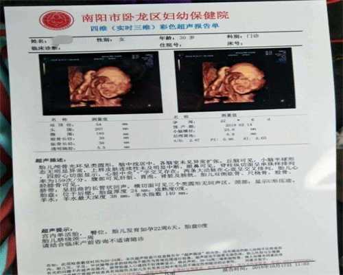 上海代孕的机构有哪些_吃避孕月经提前3天来了是怎么了