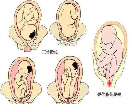 上海代孕产子的好处_怎么缓解孕妇胃酸