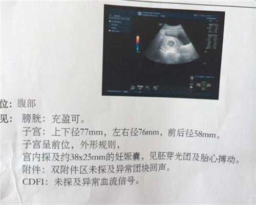 上海代生儿子中心_宫外孕手术有后遗症吗