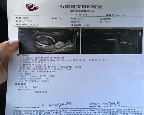 上海代孕哪家优惠_经常用多普勒听胎心对宝宝有影响吗