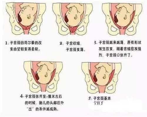 上海代孕可以选男女吗_初产妇能不能吃香蕉