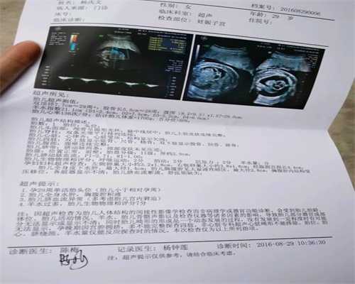 上海代孕包代生孩子_怀孕42天一定要做阴超吗