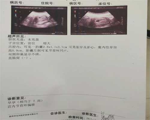 上海代孕双胞胎的公司_血hCG检查作用大 请你认真来对待