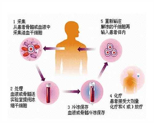 上海代孕可选男女_新生儿缺氧的病因，新生儿缺氧的症状