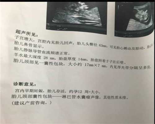 上海代怀孕包成功多少钱_儿童游泳 小心中耳炎