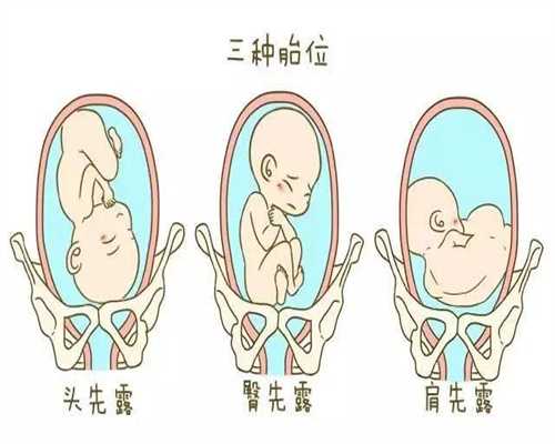 上海代孕网公司_对待孩子要关爱，不能溺爱