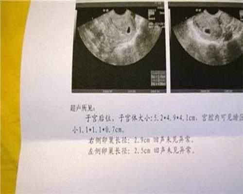 上海代孕机构_孕早期先兆流产后怎么养胎