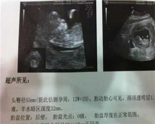 上海代孕是否合法_小孩经常深呼吸怎么回事？