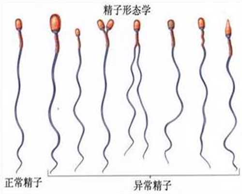 上海代孕生子QQ群_一般怀孕多久有胎心胎芽