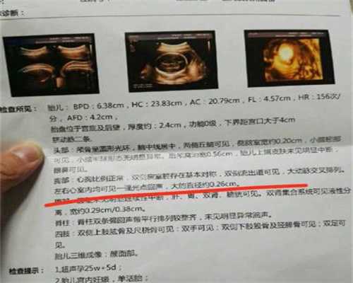 上海代孕移植_上海试管好吗_上海找女人代孕电话
