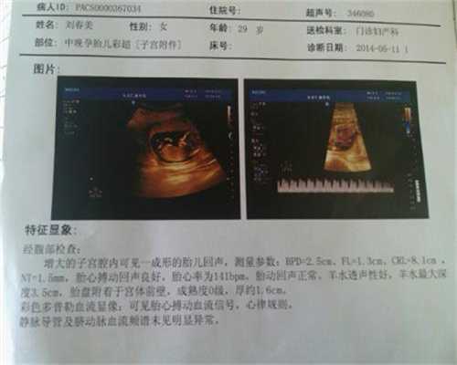 上海代孕咨询-上海靠谱代妈哪里找-上海代孕公司有做过吗