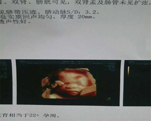 上海代孕三包：上海世纪代孕成功率高_上海代孕医生咨询