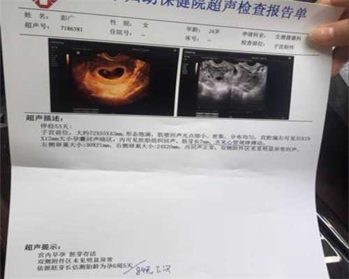 上海那家代孕做的好：上海盼盼代孕生殖医院_上海怎么找代孕