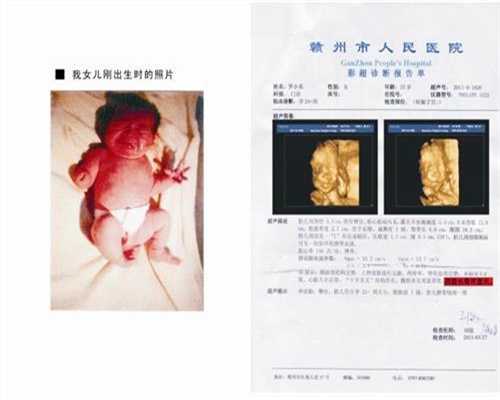 上海代孕手术得多少钱：上海代孕生子网包生女孩_上海世纪代孕成功率最高