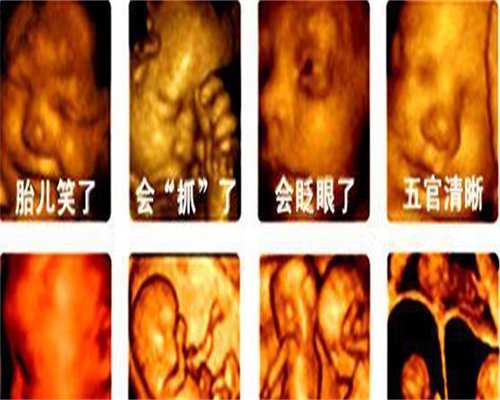 上海代孕的孩子归谁：上海盼盼代孕生殖医院_上海代怀孕世纪代孕