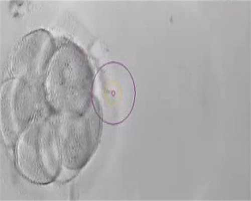 泰国供卵试管婴儿-上海专业的合法代孕_了不起的孕妈：卵巢功能不好就只能做