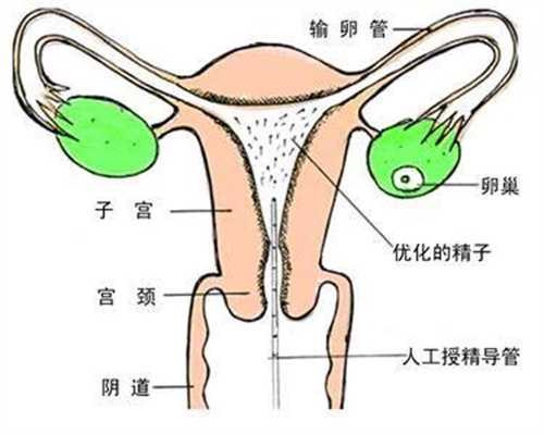上海有供卵试管吗-找代孕靠谱吗_泰国第三代试管婴儿与国内的试管婴儿有什么