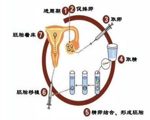 代孕生子成功率-上海代孕孩子可以嘛_多囊促排的整个过程及全部费用，你了解