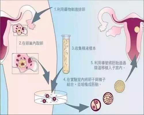 上海代孕生儿子价格-代孕2022的价目表_曼谷医院，我们来了！