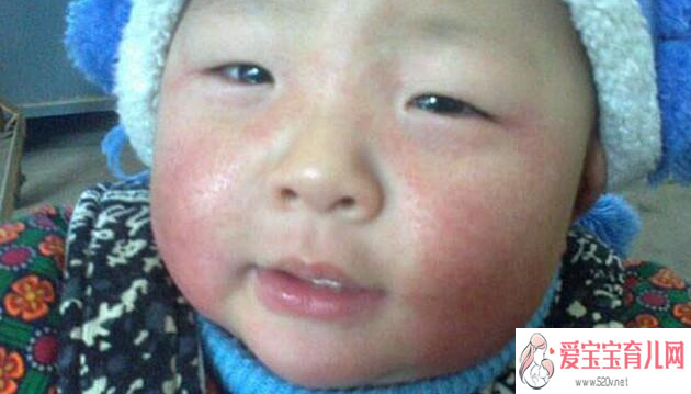 上海中国哪里有代孕公司-代生机构代孕产子_母乳能给宝宝擦脸吗春季宝宝皮肤