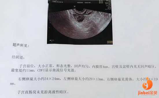 哪里去做代孕较好-上海借腹生子生殖中心选性别_泰国做三代试管婴儿最好医院